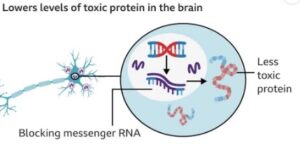 first successful treatment of Huntington's disease