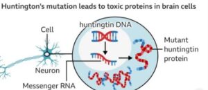 first successful treatment of Huntington's disease