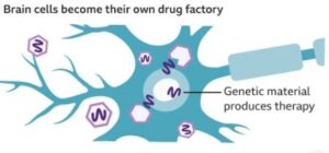 first successful treatment of Huntington's disease