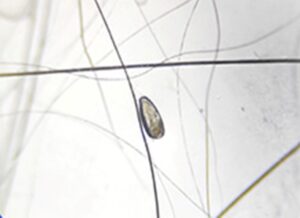 flea characteristics