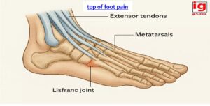 top of foot pain