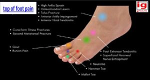 top of foot pain
