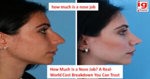 how much is a nose job